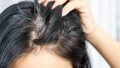 Wellhealthorganic.com/know-the-causes-of-white-hair-and-easy-ways-to-prevent-it-naturally