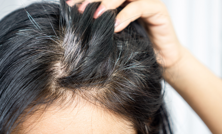 Wellhealthorganic.com/know-the-causes-of-white-hair-and-easy-ways-to-prevent-it-naturally